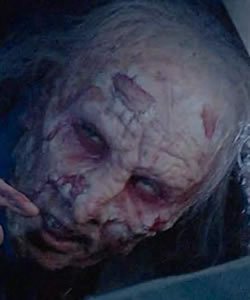 Escalante (Leprosy Patient)