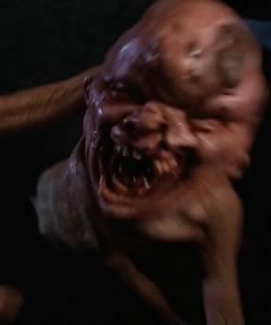 Leonard (Conjoined Twin)